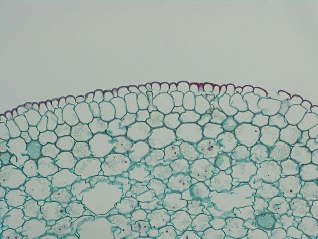 Ranunulus Root CS Slides - Ranunulus Root CS 02 200X